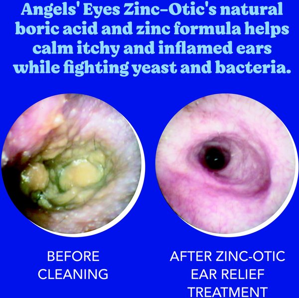 Show full view: Angels' Eyes Zinc-Otic Ear Relief Treatment for Dogs & Cats, 1-fl oz bottle slide 5 of 8