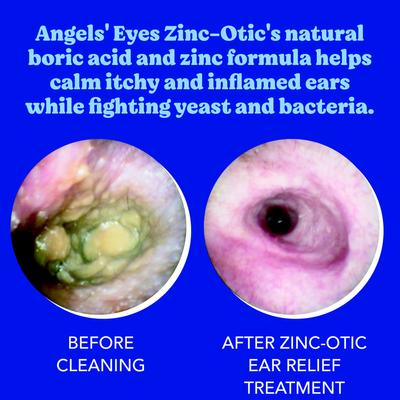 Show full view: Angels' Eyes Zinc-Otic Ear Relief Treatment for Dogs & Cats, 1-fl oz bottle slide 6 of 9