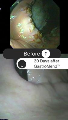 Show full view: SynNutra Equine GastroMend Horse Supplement, 60 Servings slide 3 of 3