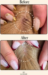 Goldie Miracle Mist Spray Dog Hot Spot Relief, 8-fl oz bottle slide 2 of 8