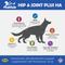 Show in main carousel: PeakTails Arthrix Hip & Joint Plus HA Dog Supplement, 150 count slide 3 of 8