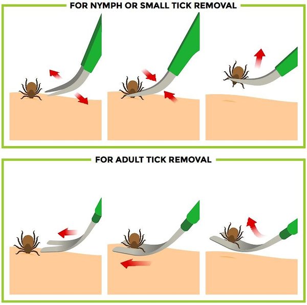 TickCheck Premium Dog Tick Removal Kit