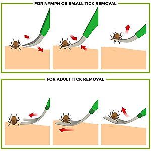 TickCheck Premium Dog Tick Removal Kit