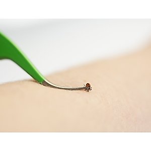 TickCheck Premium Dog Tick Removal Kit