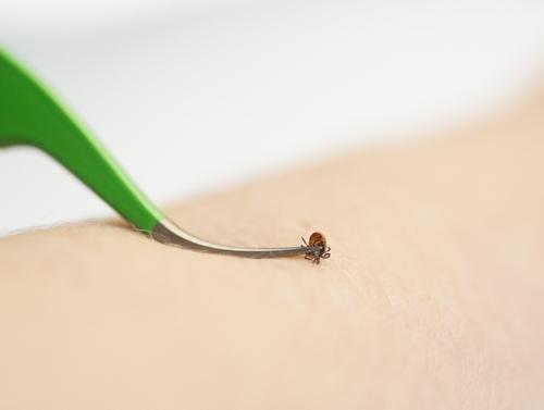 Show full view: TickCheck Premium Dog Tick Removal Kit slide 4 of 8