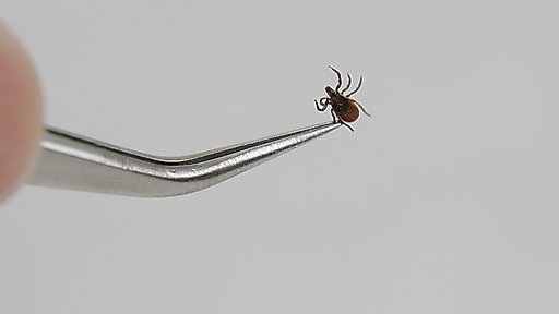 TickEase Tick Removal Tweezer Tool